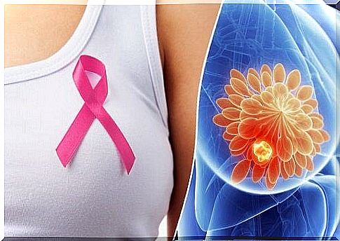 10 warning signs of breast cancer