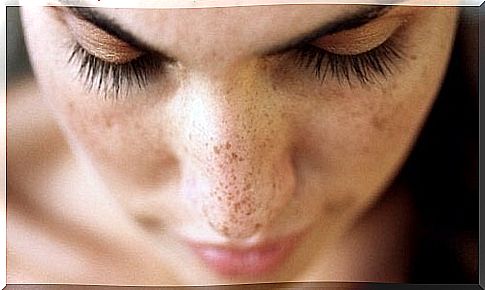 6 natural remedies that will remove blackheads on your face