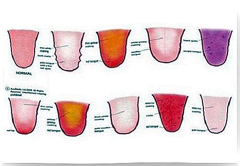 9 things your tongue is trying to tell you about your health