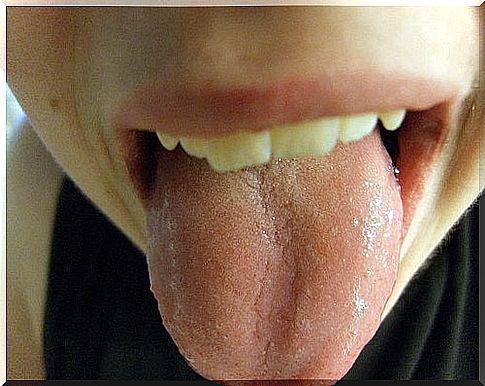 Lesions on the tongue