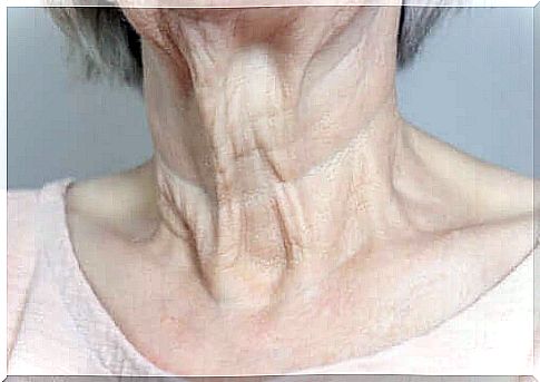 Wrinkled neck