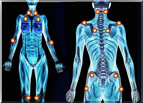 How to relieve the symptoms of Fibromyalgia