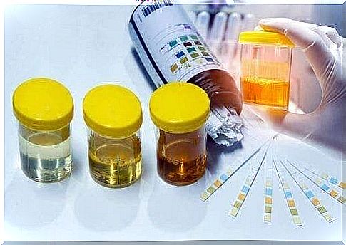 Urine samples ready to be tested