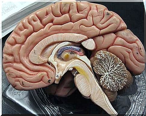 Illustration of brain with subarachnoid and subdural hemorrhages