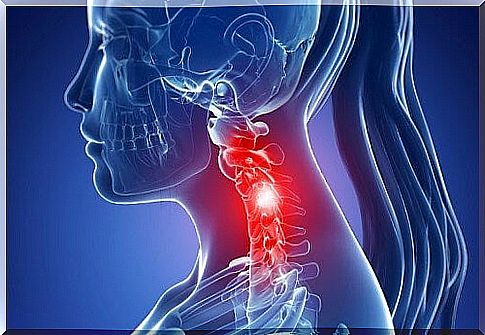 Symptoms of cervical spondylosis and natural treatment