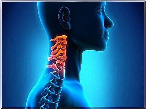 cervical spondylosis