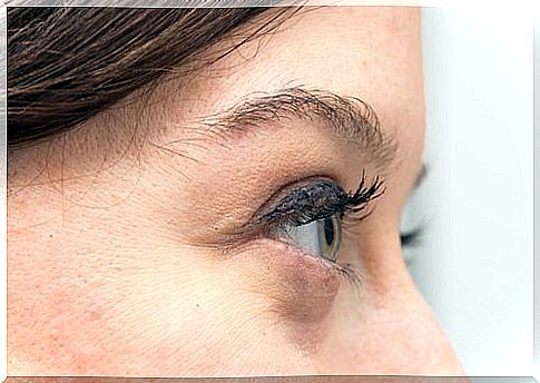 That's why you have bags under your eyes, and how to treat them naturally