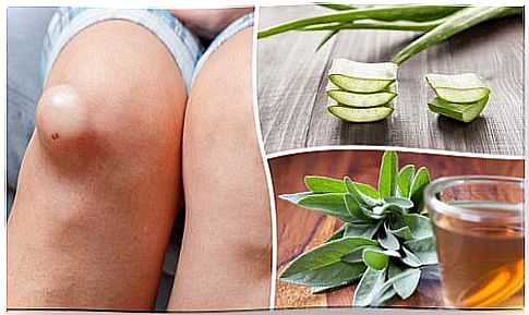 Try the five best remedies for swollen knees