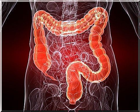 Ulcerative colitis: Causes, symptoms and treatment