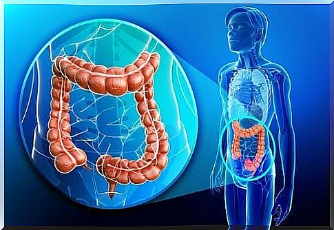 Ulcerative Colitis